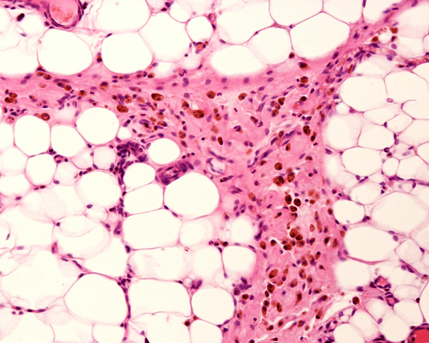 Mechanisms Behind Peptide